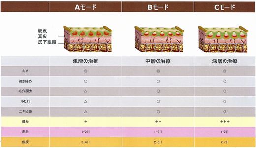 治療レベルの選択